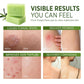 Roycederm Tea Tree Oil Antifungal Soap