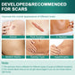 AirroYE Silicone Scar Sheets