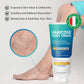Hermon Varicose Veins Cream