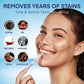 AsaVea Smile Teeth Whitening Pen